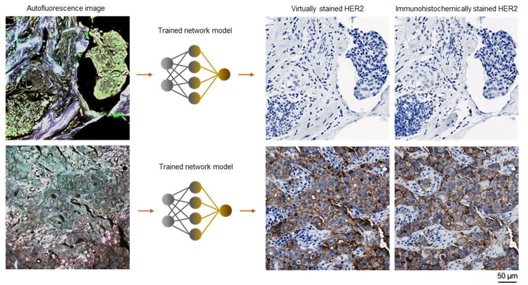 Label-free virtual HER2 immunohistochemical staining of breast tissue using deep learning