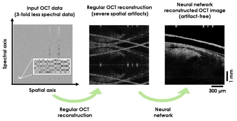 Deep Learning-Trained Neural Network Reconstructs OCT Images