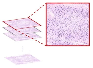UCLA deep-learning reduces need for invasive biopsies